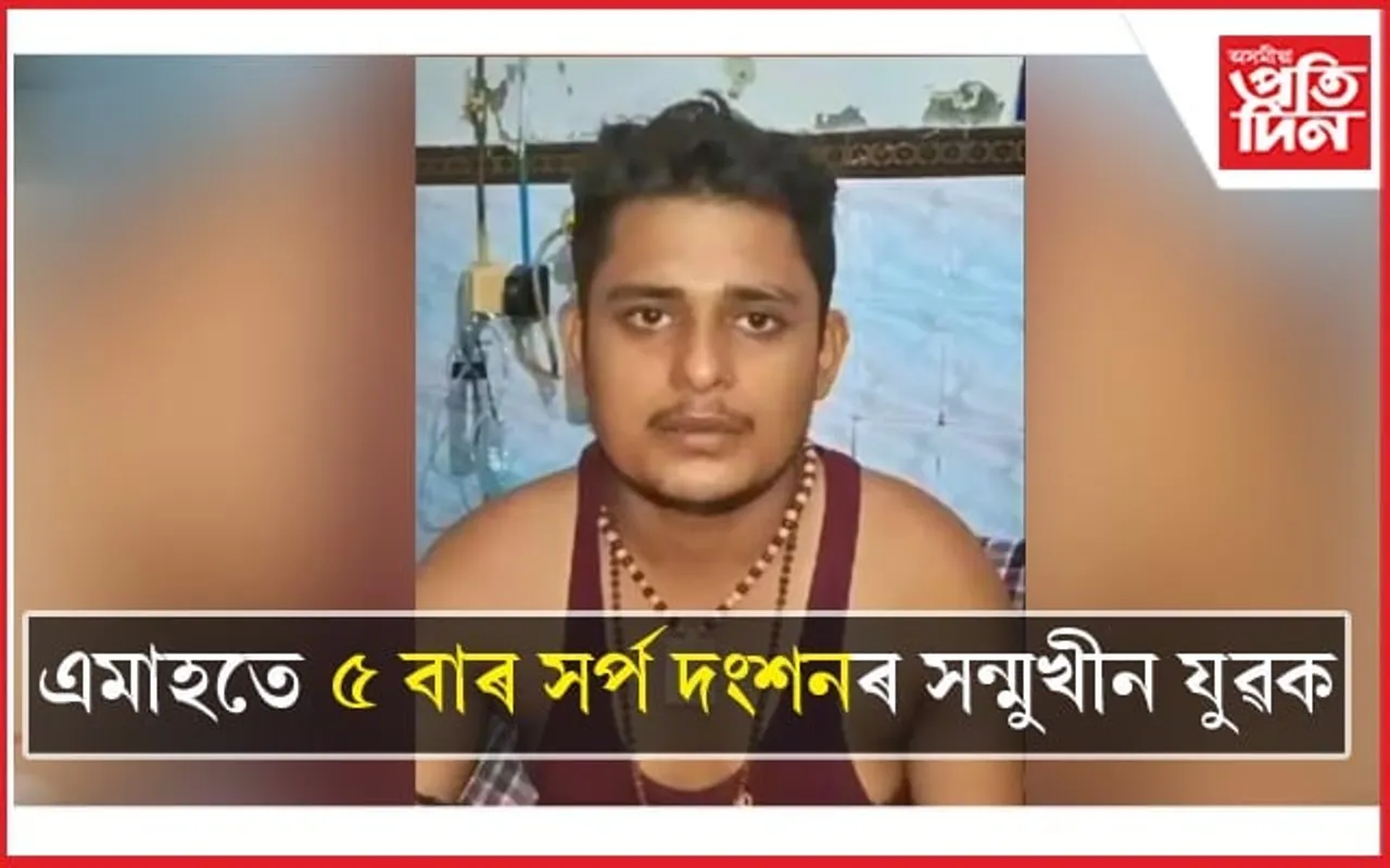 এমাহতে ৫ বাৰ সৰ্প দংশনৰ সন্মুখীন যুৱকঃ চিন্তিত পৰিয়াল, চিকিৎসক...